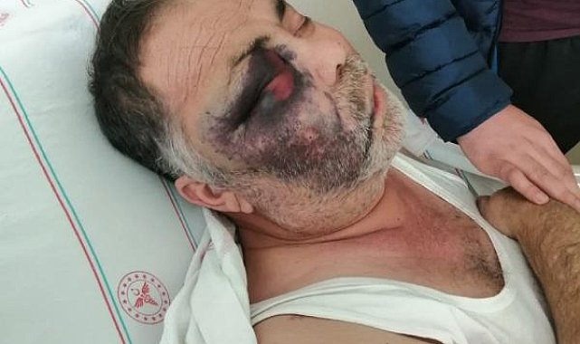 Engelliyi döverek öldürmekle suçlanan baba-oğlun beraatine itiraza ret