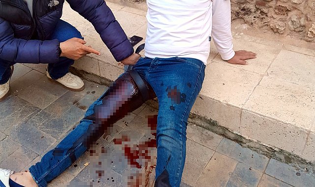 Tartıştığı butik sahibine pompalı tüfekle saldırdı: 3 yaralı